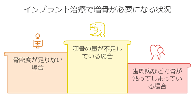 増骨が必要になる場合