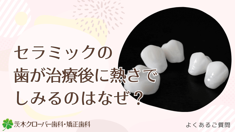 セラミックの歯が熱い！しみる！となるのはなぜ？