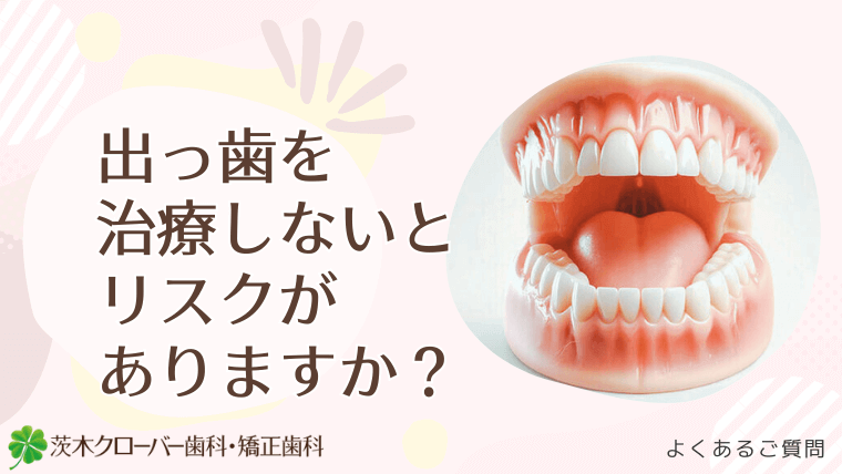 出っ歯を治療しないとリスクがありますか？