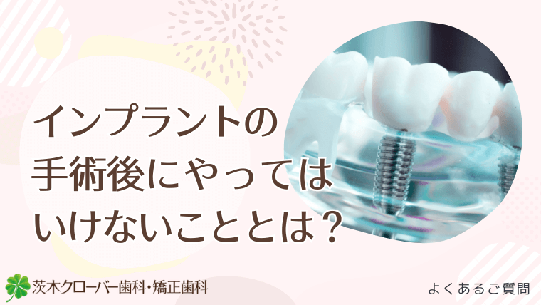 インプラントの手術後にやってはいけないこととは？