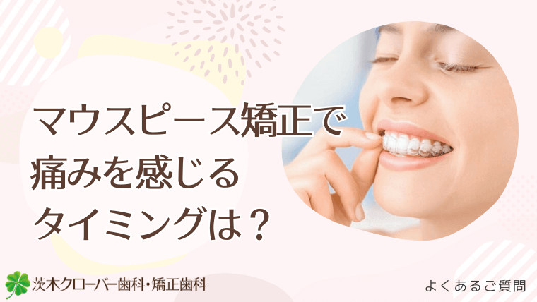 マウスピース矯正で痛みを感じるタイミングは？