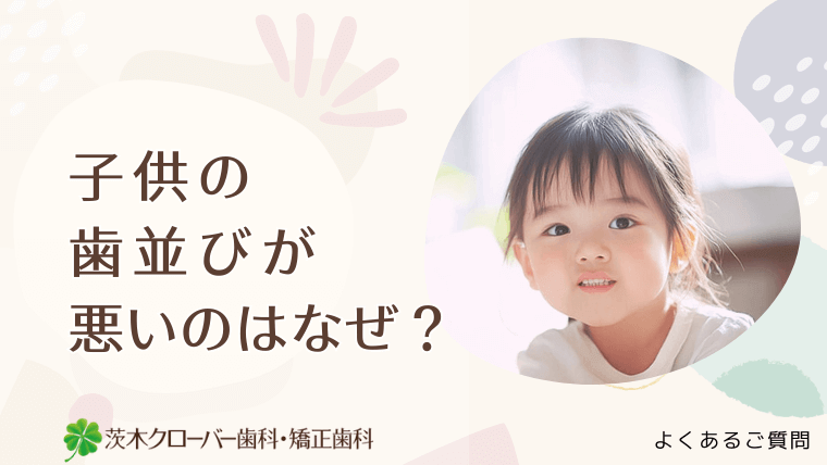 子供の歯並びが悪いのはなぜ？