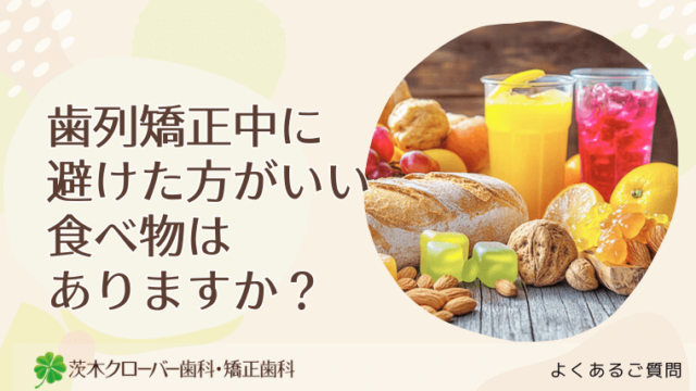 歯列矯正中に避けた方がいい食べ物はありますか？