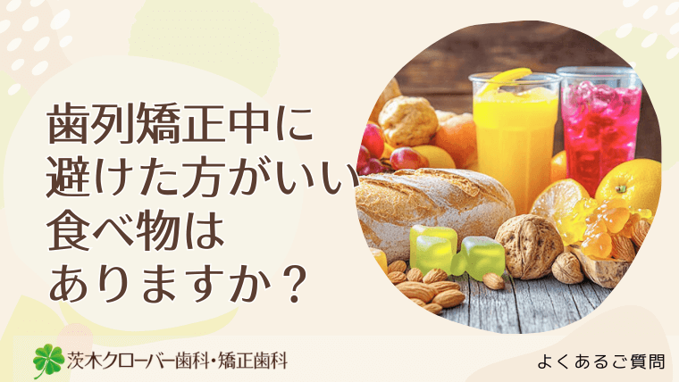 歯列矯正中に避けた方がいい食べ物はありますか？